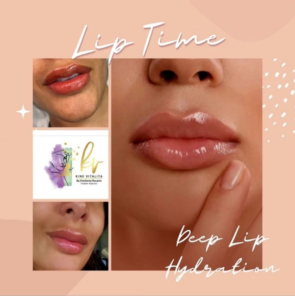 KineVitalita Lip Hydration - Picture 2 of 3